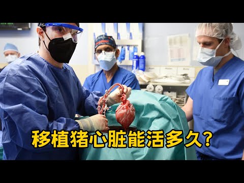 转基因猪心脏移植 世界第二例猪心脏移植患者死亡