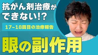 【進行・再発がん・ステージ４】抗がん剤治療で起きる目の副作用？！