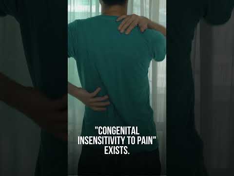 Feeling No Pain: The Unbelievable Condition! 🚫😲 #NoPainCondition #MedicalMarvels #Shorts