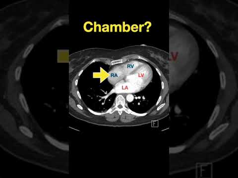 Heart Anatomy #shorts - Part F