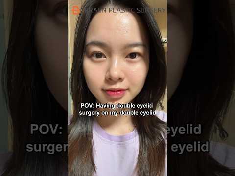 Having double eyelid surgery on my double eyelid👀 #fyp #beforeandafter #glowup #doubleeyelidsurgery