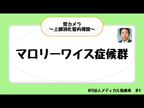 マロリーワイス症候群（Mallory-Weiss syndrome）とは