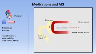 Acute Kidney Injury (Part 1/3 - Definitions and Etiologies)