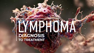 Exploring Lymphoma Treatment Options