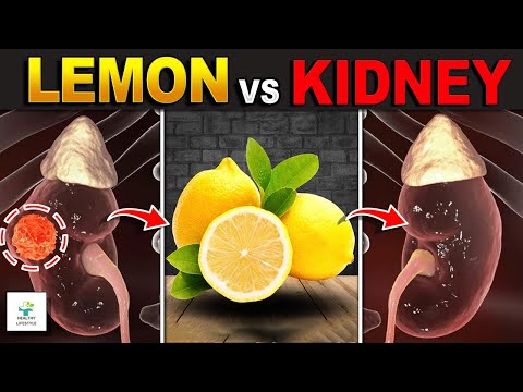 Top 9 Amazing Benefits of Lemon that You May Not Know | Healthy lifestyle