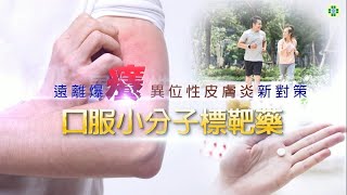 遠離爆癢 異位性皮膚炎新對策－口服小分子標靶藥