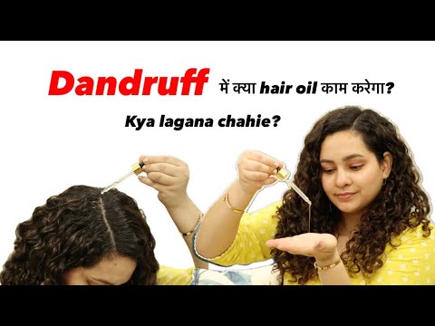 Dandruff के लिए बेस्ट तेल? What is BEST for Dandruff - Oil or Serum? (How I control my dandruff)