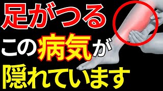 【医師監修】足のつりに隠れた病気とその対処法【こむら返り】