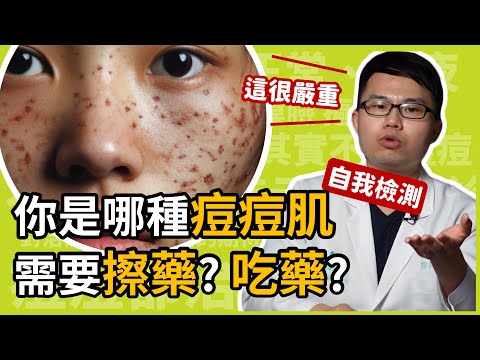 你是哪種痘痘肌？長兩顆痘痘算嚴重？應該吃藥、還是擦藥呢？皮膚科楊省三醫師教你自我檢測痘痘嚴重程度！