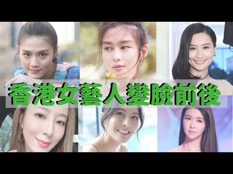 23位香港女星整容前後 原來她她她也有變臉？成功vs失敗案例