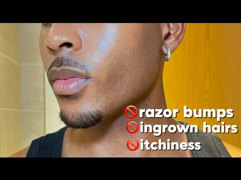 How to get rid of razor bumps & ingrown hairs (Tutorial)