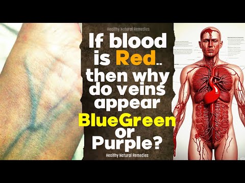 Is it disease? If blood is red, then why do veins appear blue-green, purple? Blood problems. Health