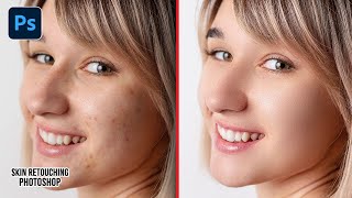 Advance Skin Retouching 2025 | High-End Face Retouching - Best Photoshop Tutorial