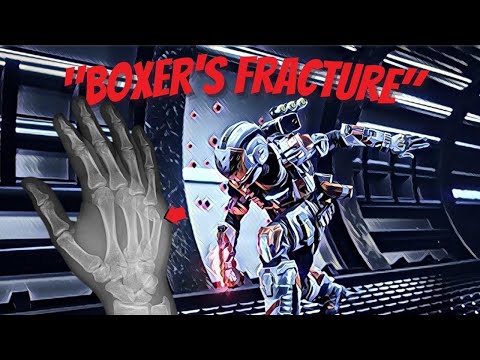 I BROKE MY HAND... And Still Played Apex Legends *not clickbait*