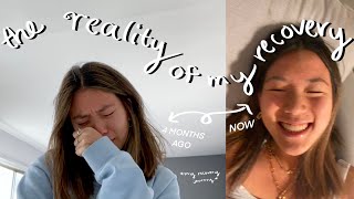 the reality of recovering from an ED *my journey*