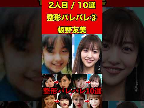 板野友美③整形がバレバレな芸能人！10選 #芸能界の闇 #ゴシップ #整形 #芸能人 #噂話 #有名人  #雑学 #モデル #芸能 #女優 #アイドル #美容