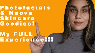 PHOTOFACIALS & NEOVA GOODIES - MY FULL EXPERIENCE