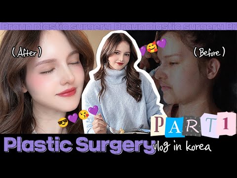 Revision rhinoplasty at Braun plastic surgery in Korea (with Lisa from Germany)