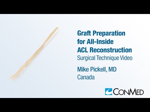 Dr. Mike Pickell - Graft Prep for All Inside ACL Reconstruction - CONMED Surgical Technique