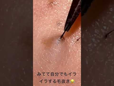 ピンセット毛抜き