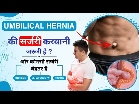 What is Umbilical Hernia in Hindi | Umbilical Hernia - Causes, Recovery, Symptoms & Treatment