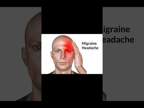 Types of headache