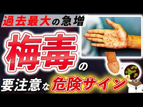 絶対に見逃してはいけない「梅毒」が引き起こす体の変化。初期の危険サインとは？予防法とは？なぜ急増しているのか？医師が徹底解説！