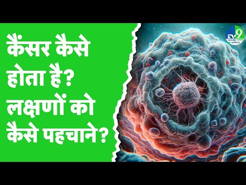 Health News: Dr. Ankita Patel ने बताया- इंसान क्यों हो जाता है Cancer का शिकार?