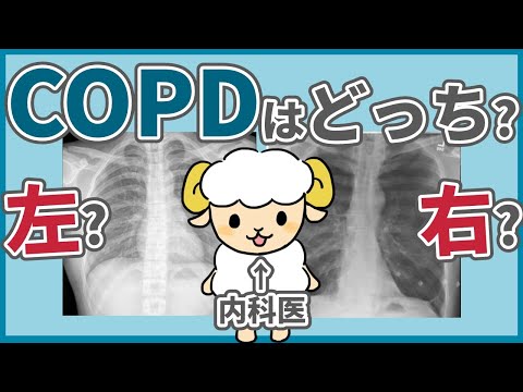 COPDのレントゲンを徹底解説【動画内で読めるようになります】