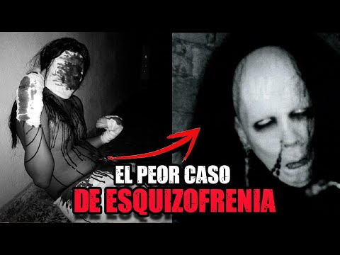 ¿Se quitó las MANOS y se puso PEZUÑAS DE CERDO? l El oscuro caso de Natramm