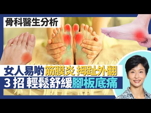 足底筋膜炎＋拇趾外翻｜女性較易筋膜炎和拇趾外翻？腳板底痛教你3招伸展運動在家輕鬆舒緩筋膜炎！週末運動員較易阿基里斯肌腱撕裂｜王建芳醫生 骨科醫生張文康醫生｜人類健康研究所