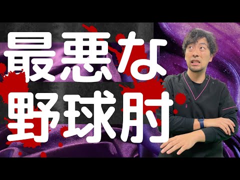 【最悪】外側野球肘!!　ここの痛みだけは我慢してはいけない!!