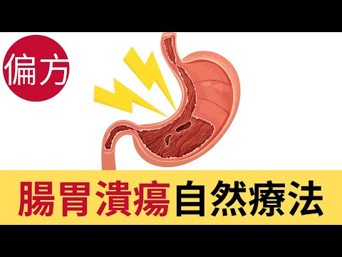 腸胃潰瘍自然療法