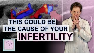 Varicocele - Is it killing your fertility? Learn what to do