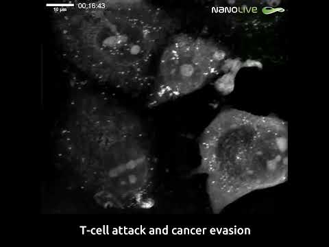 T-cell attack and cancer evasion