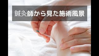 【日本医専】鍼灸師から見た施術風景