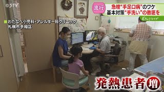 急増する子どもの夏風邪　手や足、口の中に発疹「手足口病」が警報レベルに　札幌市