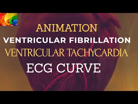 Cardiac Rhythms Animation|| Ventricular Fibrillation and Ventricular Tachycardia ||NO COPYRIGHT VFX