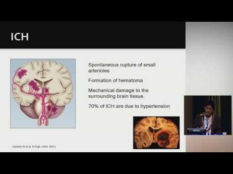 Disparities in Stroke   Kazuma Nakagawa