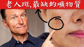 老人斑,第一名缺的礦物質,自然療法,柏格醫生 Dr Berg