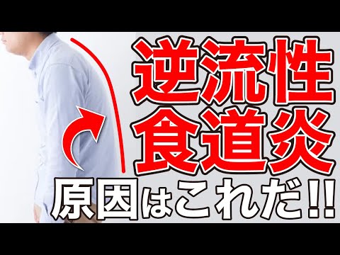 今すぐ試して！逆流性食道炎を一瞬で楽にする必殺エクササイズ