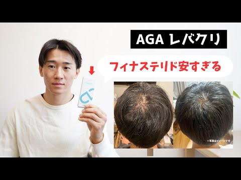 【AGA治療】レバクリが破格すぎる… オンラインクリニックのここがすごい！