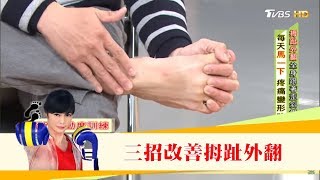 腰痛查不出原因，竟是「拇指外翻」造成的！三招改善讓腳不變形 健康2.0