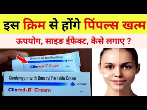 How to use clinred b cream // how to apply clinred b cream #cngajbhiye #cnmedicineinfo #clinredgel