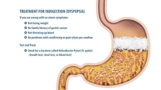 Indigestion vs. Acid Reflux Disease