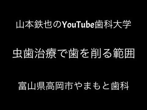 歯科治療の正しい理解　虫歯治療は富山県高岡市のやまもと歯科