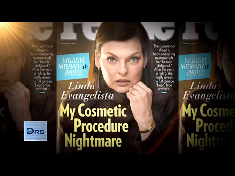 What Happened with Linda Evangelista and the Fat Freezing Procedure?