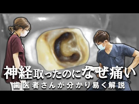 神経を取ったのに痛い…その理由は神経が残っているから？歯医者さんが分かり易く解説します！　＃根管治療