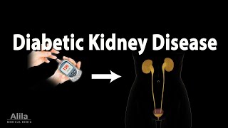 Diabetic Kidney Disease, Animation