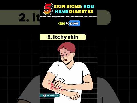 5 Hidden Skin Signs of Diabetes | Diabetes skin signs | Diabetes symptoms #shortsvideo #diabetes